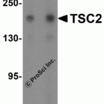 Western blot analysis of TSC2 in Jurkat cell lysate with TSC2 antibody at (A) 1 and (B) 2 μg/mL..