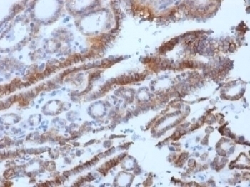 TSHR beta chain Antibody [SPM222]