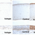 <strong>Figure 6 Induced Expression Validation of TSLP in Human Corneal Epithelium  (Lin et al., 2018)</strong><br> Immunohistochemical images showing theTSLP protein detected by anti-TSLP antibodies in donor corneal tissues without (Control) or after exposure to IL-32 ex vivo; an isotype IgG antibody was used as a negative control. The production of TSLP was increased after IL-32 treatment.