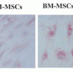 <strong>Figure 10 Induced Expression Validation of TSLP in Human Corneal Tissues (Lin et al., 2013) </strong><br>Immunohistochemical images showing TSLP protein detected by anti-TSLP antibodies in ex vivo donor human corneal tissues without (B1) or with exposure to IL-33 (10ng/mL) (B2). An isotype IgG antibody (B3) was used as a negative control. Magnificaiton 400X. The staining confirms the increased level of TSLP after IL-33 treatment.