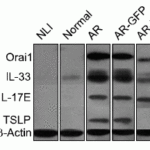 <strong>Figure 4 Induction Validation of TSLP in Nasal Mucosa of Allergic Rhinitis (AR) mice (Wang et al., 2012)</strong><br> Western Blot images showing theTSLP protein detected by anti-mouse TSLP antibodies in normal mice (Control) or AR mice.  TSLP protein expression levels  were higher in AR mice and AR-GFP mice.