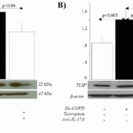 <strong>Figure 5 Regulated Expression Validation of TSLP in COPD Patients. (Anzalone et al., 2018) </strong><br>(A) shows NHBE cells, in the absence (Lane 2) or presence (Lane 3) of Tiotropium , were stimulated with rhIL-17A. (B) shows NHBE cells, with ISs from COPD patients untreated (Lane 2 and Lane 3) or treated (Lane 4) with anti-IL-17A antibody. (A) and (B) show TSLP expression decreases with the treatment of anti-cholinergic drugs.