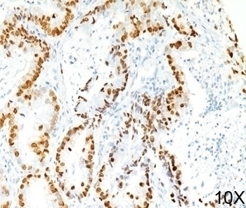 TTF-1 Antibody [8G7G3/1]