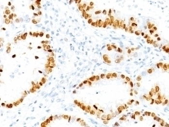TTF1 Antibody [NX2.1/690]