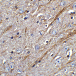 <strong>Figure 6 Immunohistochemistry Validation of TWEAK in Mouse Brain Tissue </strong><br> Immunohistochemical analysis of paraffin-embedded mouse brain tissue using anti-TWEAK antibody (3791) at 5 μg/ml. Tissue was fixed with formaldehyde and blocked with 10% serum for 1 h at RT; antigen retrieval was by heat mediation with a citrate buffer (pH6). Samples were incubated with primary antibody overnight at 4°C. A goat anti-rabbit IgG H&L (HRP) at 1/250 was used as secondary. Counter stained with Hematoxylin.