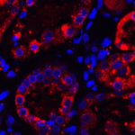 Immunofluorescence of TXNIP in human kidney tissue with TXNIP antibody at 5 μg/ml.<br><br>Red: TXNIP Antibody (7941) <br> Blue: DAPI staining