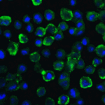 Immunofluorescence of TYK2 in A549 cells with TYK2 Antibody at 20 μg/ml.