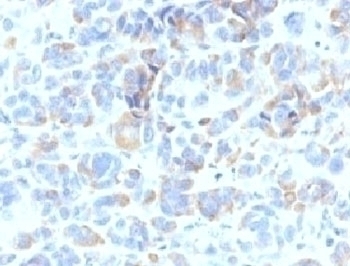 TYRP1 Antibody [TYRP1/807]