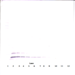 To detect hTARC by Western Blot analysis this antibody can be used at a concentration of 0.1 - 0.2 ug/ml. Used in conjunction with compatible secondary reagents the detection limit for recombinant hTARC is 1.5 - 3.0 ng/lane, under either reducing or non-reducing conditions.