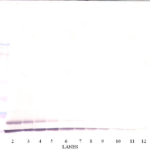 To detect hTARC by Western Blot analysis this antibody can be used at a concentration of 0.1 - 0.2 ug/ml. Used in conjunction with compatible secondary reagents the detection limit for recombinant hTARC is 1.5 - 3.0 ng/lane, under either reducing or non-reducing conditions.