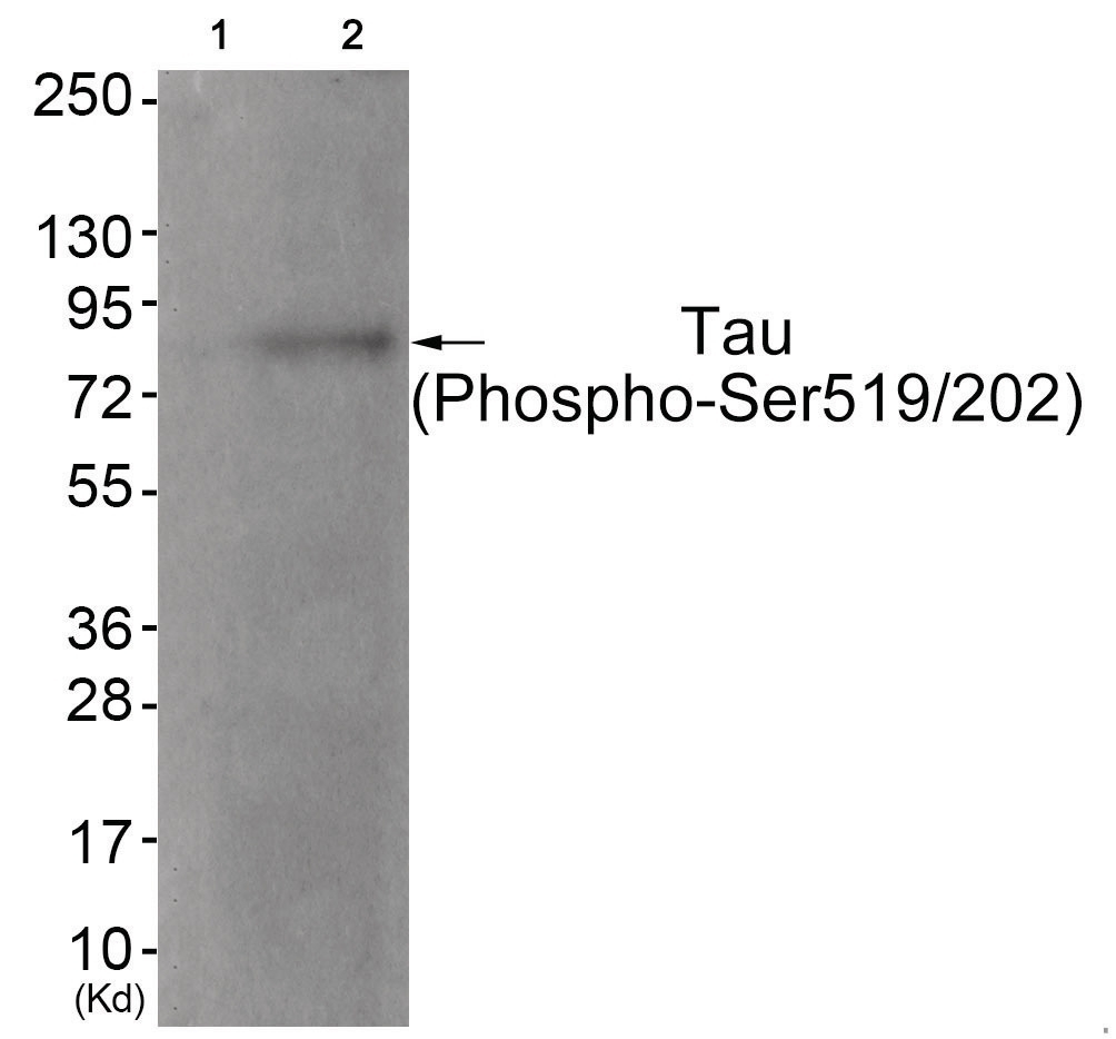 Tau (phospho Ser519/202) Antibody