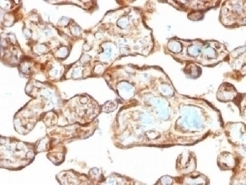 Thymidine Phosphorylase Antibody [P-GF.44C]