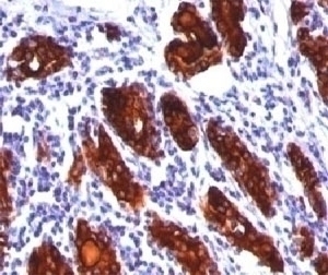 Thyroglobulin Antibody [2H11 or TGB04]