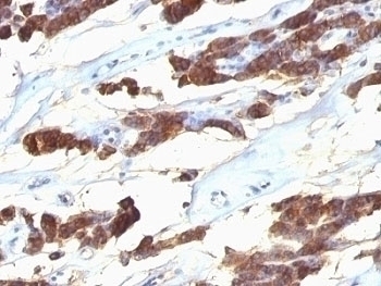 Thyroglobulin Antibody [SPM221]