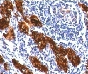 Thyroglobulin Antibody [TG157-2]