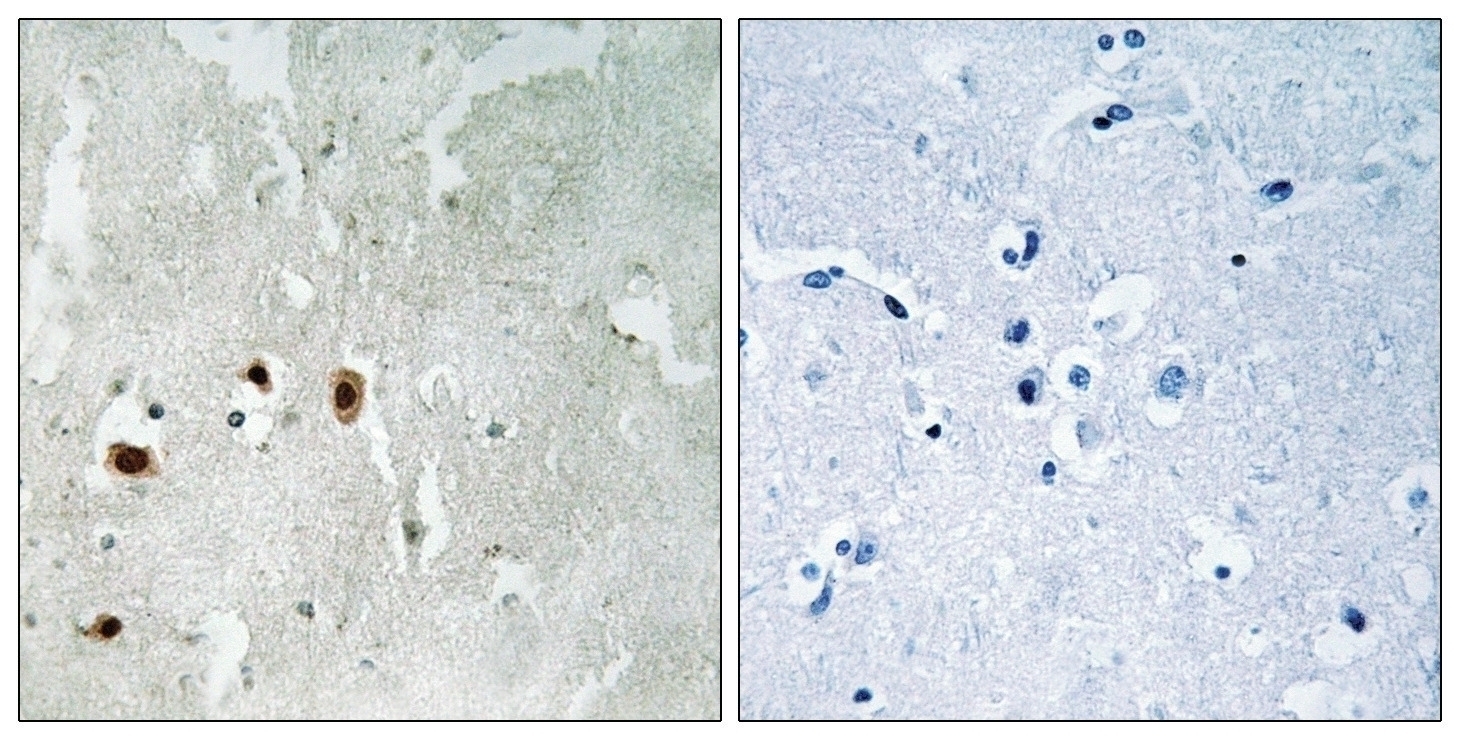 Tip60 (phospho Ser90) Antibody