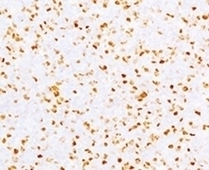 Topoisomerase II alpha Antibody [TPM2A-2]