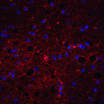 Immunofluorescence of TRAIL in human brain tissue with Trail antibody at 20 μg/mL.<br><br>Red: Trail Antibody (1113) <br> Blue: DAPI staining