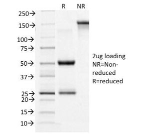 Transferrin Receptor Antibody [TFRC/1396]