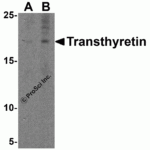 Western blot analysis of Transthyretin in HepG2 cell lysate with Transthyretin antibody at (A) 1 and (B) 2 μg/mL.