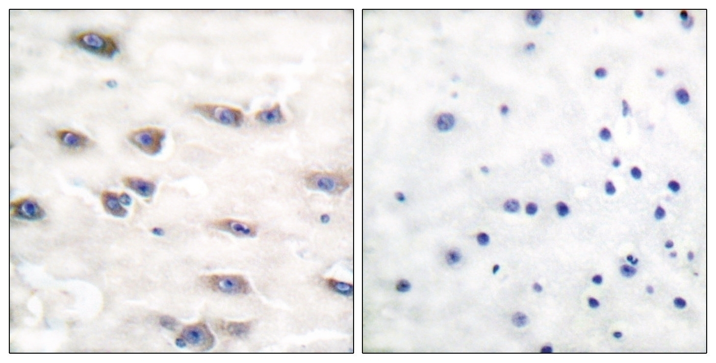 Trk A (phospho Tyr791) Antibody