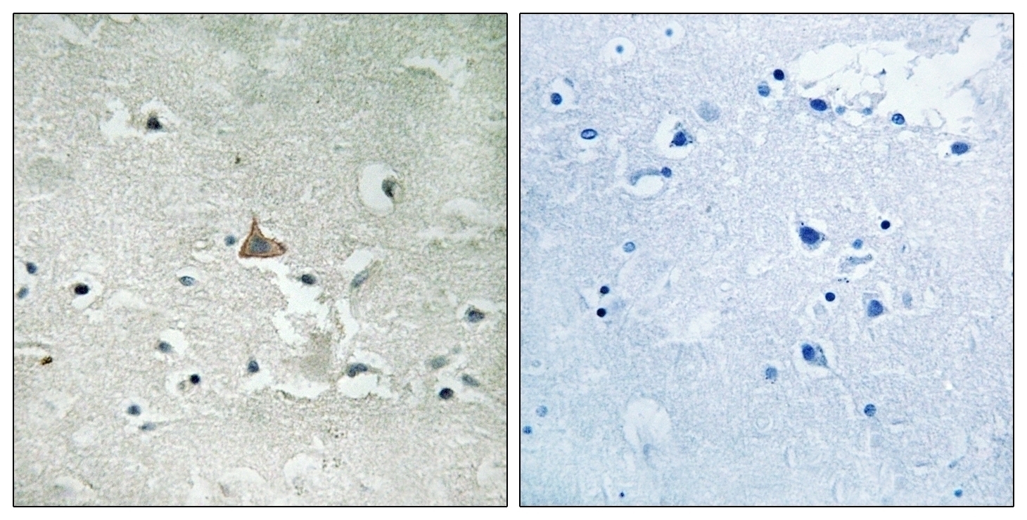 Trk B (phospho Tyr706/Tyr707) Antibody