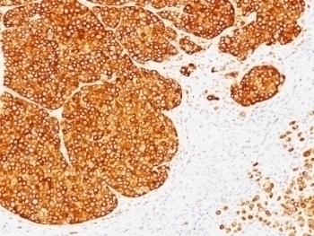 Tyrosinase Antibody [SPM360]