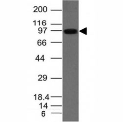 UACA Antibody [UACA/1222]