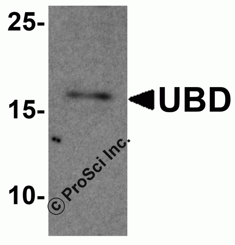 UBD Peptide