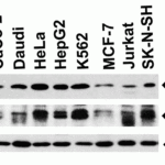 <strong>Figure 2 Independent Antibody Validation (IAV) via Protein Expression Profile in Human Cell Lines</strong><br>Loading: 15 μg of lysates per lane.Antibodies: UNG1, 3863 (0.5 μg/mL), UNG1, 3865 (4 μg/mL), beta-actin 3779 (1 μg/mL),  1h incubation at RT  in 5% NFDM/TBST.Secondary: Goat anti-rabbit IgG HRP conjugate at 1:10000 dilution.