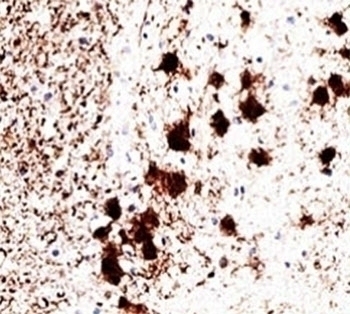 UchL1 Antibody [31A3]