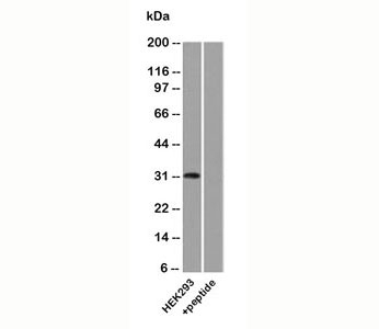Uroplakin 3A Antibody