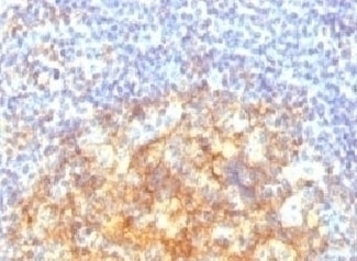 VCAM-1 Antibody [CDLA106]