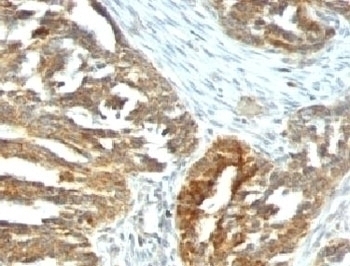 VEGF Antibody [VEGF/1063]