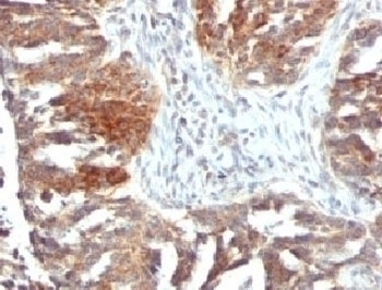 VEGF Antibody [VGFA-1]