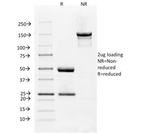 VEGFR1 Antibody [FLT1/658]
