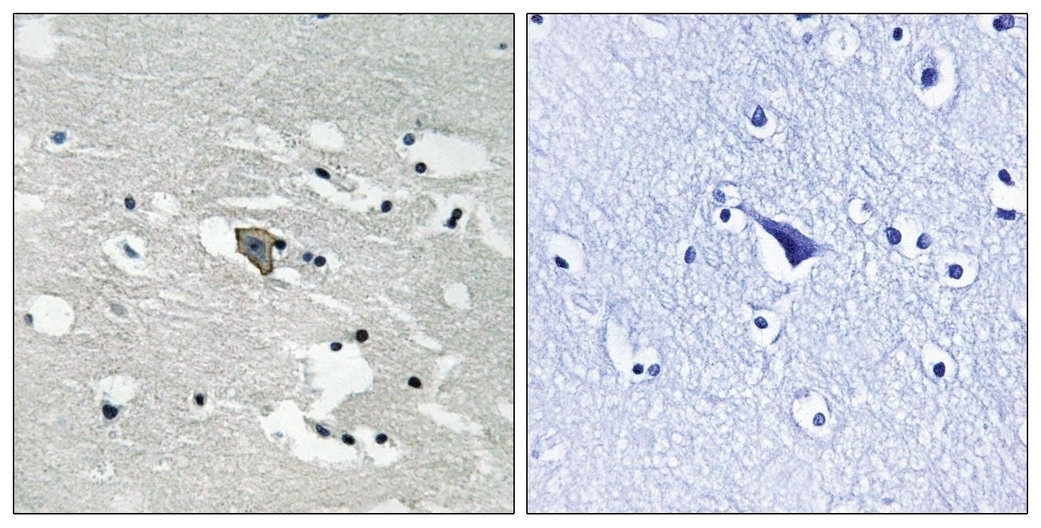 VEGFR1 (phospho Tyr1048) Antibody