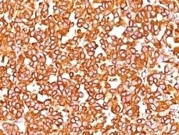 VIM Antibody [SPM576]