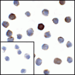Immunocytochemistry of VISTA in transfected HEK293 cells with VISTA antibody at 1 μg/mL. Lower left: Immunocytochemistry in transfected HEK293 cells with control mouse IgG antibody at 1 μg/mL.