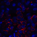 Immunofluorescence of VISTA in human lymphoma tissue with VISTA antibody at 5 μg/mL. <br><br>Red: VISTA Antibody [4C4] (RF16071) <br> Blue: DAPI staining