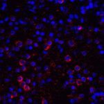 Immunofluorescence of VISTA in human spleen tissue with VISTA antibody at 10 μg/mL. <br><br>Red: VISTA Antibody [4C4] (RF16071) <br> Blue: DAPI staining