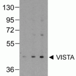 Western blot analysis of VISTA in overexpressing HEK293 cells with VISTA antibody at (A) 0.25 (B) 0.5 and (C) 1 μg/ml