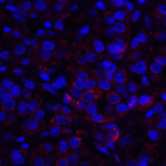 Immunofluorescence of VISTA in human lymphoma tissue with VISTA antibody at 10 μg/mL. <br><br>Red: VISTA Antibody [6D2] (RF16072) <br> Blue: DAPI staining