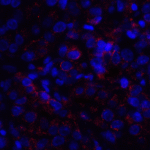 Immunofluorescence of VISTA in human lymphoma tissue with VISTA antibody at 10 μg/mL. <br><br>Red: VISTA Antibody [8E11] (RF16073) <br> Blue: DAPI staining