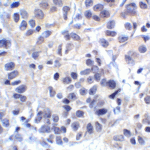 Immunohistochemistry of VISTA in human lymphoma tissue with VISTA antibody at 2 μg/mL.
