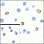 Immunocytochemistry of VISTA in overexpressing HEK293 cells with VISTA antibody at 1 μg/ml.