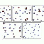 Immunocytochemistry of VISTA in over expressing HEK293 cells using (A) RF16071, (B) RF16072, (C) RF16073, (D) RF16074, and (E) control mouse IgG antibody at 1 μg/ml.
