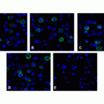 Immunofluorescence of VISTA in over expressing HEK293 cells using (A) RF16071, (B) RF16072, (C) RF16073, (D) RF16074, and (E) control mouse IgG antibody at 2 μg/ml.