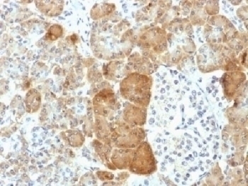 VLDLR Antibody [VLDLR/1337]
