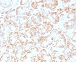 VLDLR Antibody [VLPR-1]